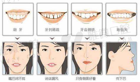 在柳州做冷光美白要多少钱？